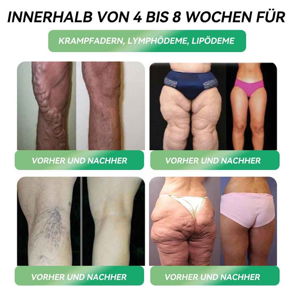 DOCTІA®💧𝐺 𝐿 𝑃-1 𝑶𝒓𝒂𝒍𝒆 𝑳öѕ𝒖𝒏𝒈 – 🏵️Erste Veränderungen in 7 Tagen sichtbar🇩🇪Für Adipositas, Herz-Kreislauf, Diabetes, Schlafapnoe, Gelenke und mehr🌿